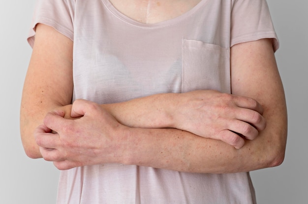 Nurture Your Skin: 5 Foods to Soothe Eczema